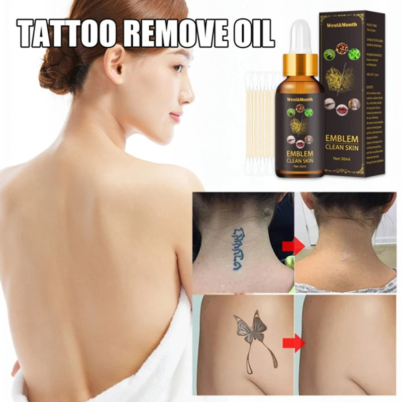 Quick Tattoo Removal Liquid Safe, Painless, and Natural Skin Cleaning