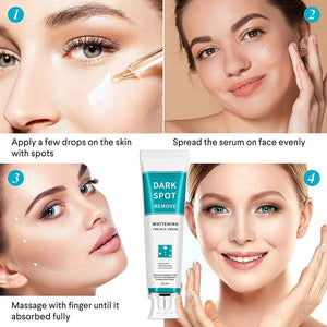 Freckle Cream Moisturizing Anti-Aging Remove Dark Spots