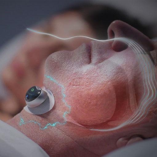 Smart Anti-snoring Device Sleep Assist, Stop Snoring & Sleep Peacefully