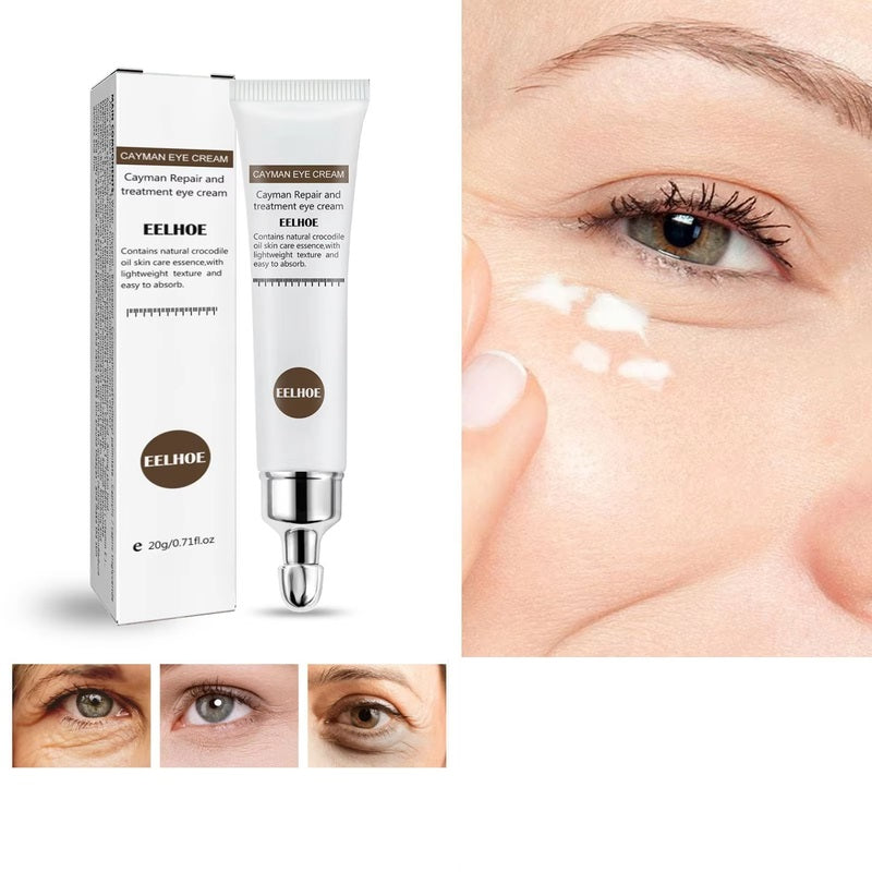 Anti-Aging Eye Cream for Dark Circles, Puffiness, and Firming