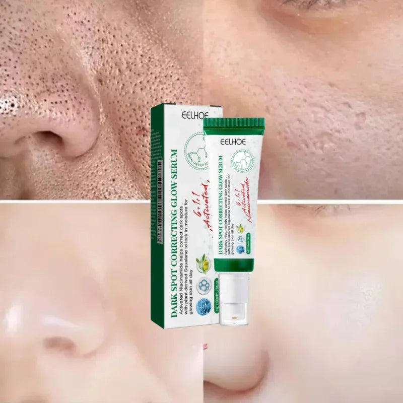 Acne Scar Repair Cream for Pores, Blackheads, and Skin Smoothing