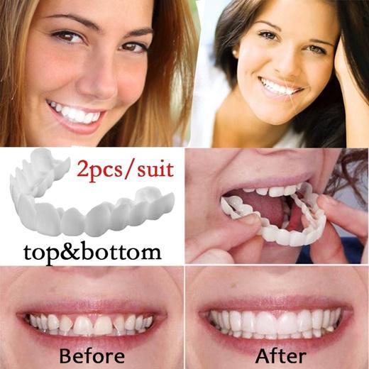 Veneers (Top & Bottom)