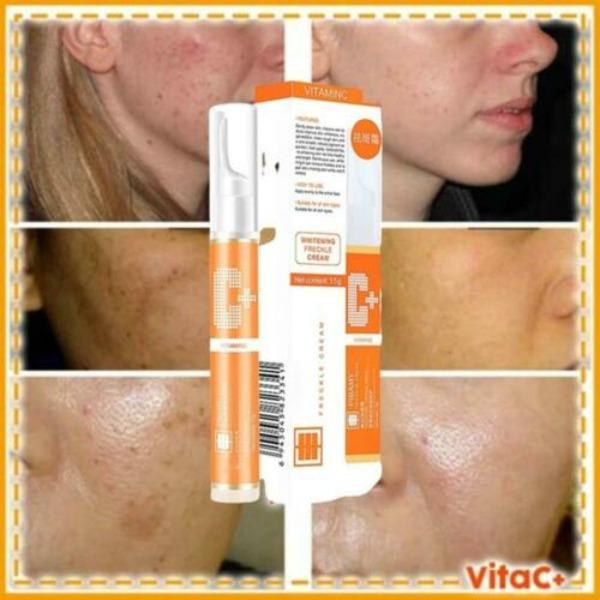 Instant Blemish Removal Gel, Whitening Repair Anti-Wrinkle Moisturizing Spot Pen