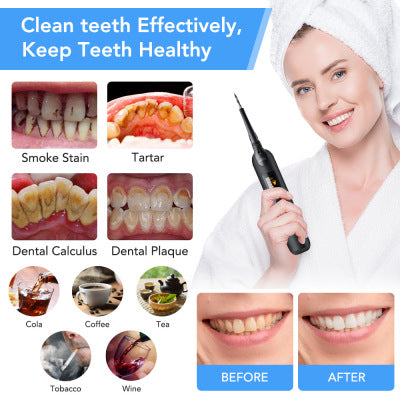 Ultrasonic Tooth Plaque Remover 5 Adjustable Modes 3 Cleaning Heads