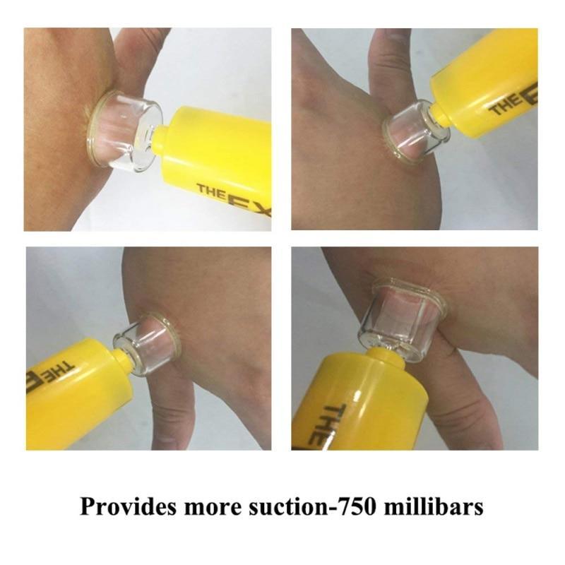 Snake And Insect Bite Kit
