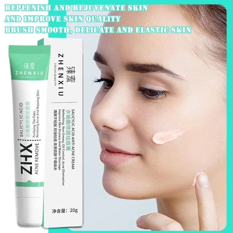 20g Salicylic Acid Acne Removal Cream for Clear Skin