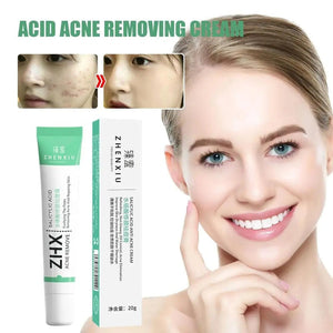 20g Salicylic Acid Acne Removal Cream for Clear Skin
