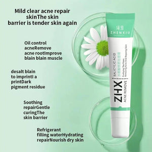 20g Salicylic Acid Acne Removal Cream for Clear Skin