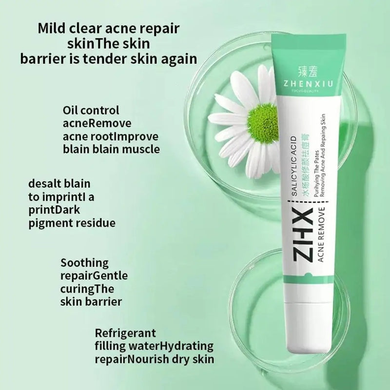 20g Salicylic Acid Acne Removal Cream for Clear Skin