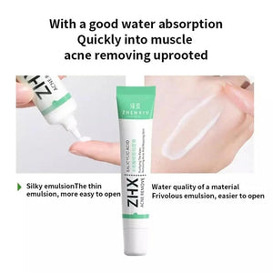 20g Salicylic Acid Acne Removal Cream for Clear Skin