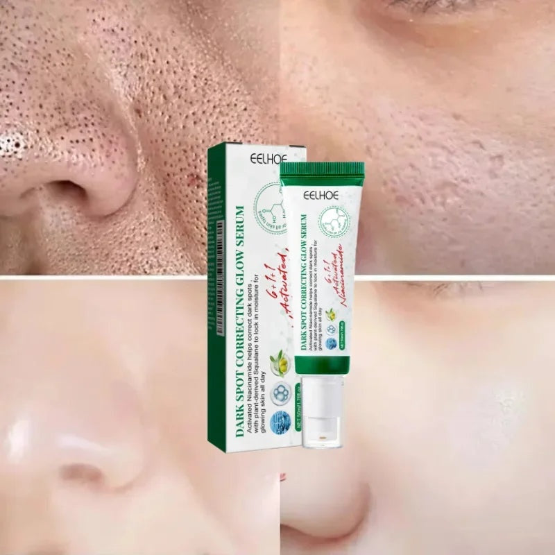 Acne Scar Repair Cream for Pores, Blackheads, and Skin Smoothing