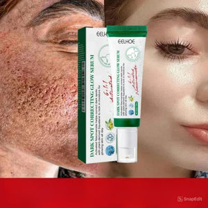 Acne Scar Repair Cream for Pores, Blackheads, and Skin Smoothing