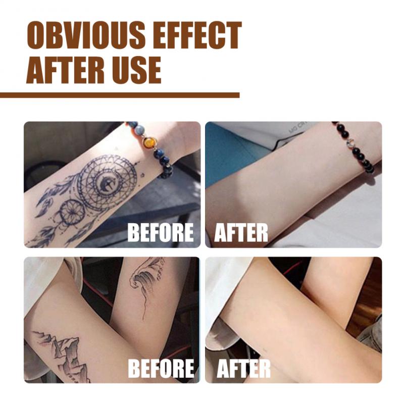 30Ml Safe Permanent Tattoo Removal Liquid