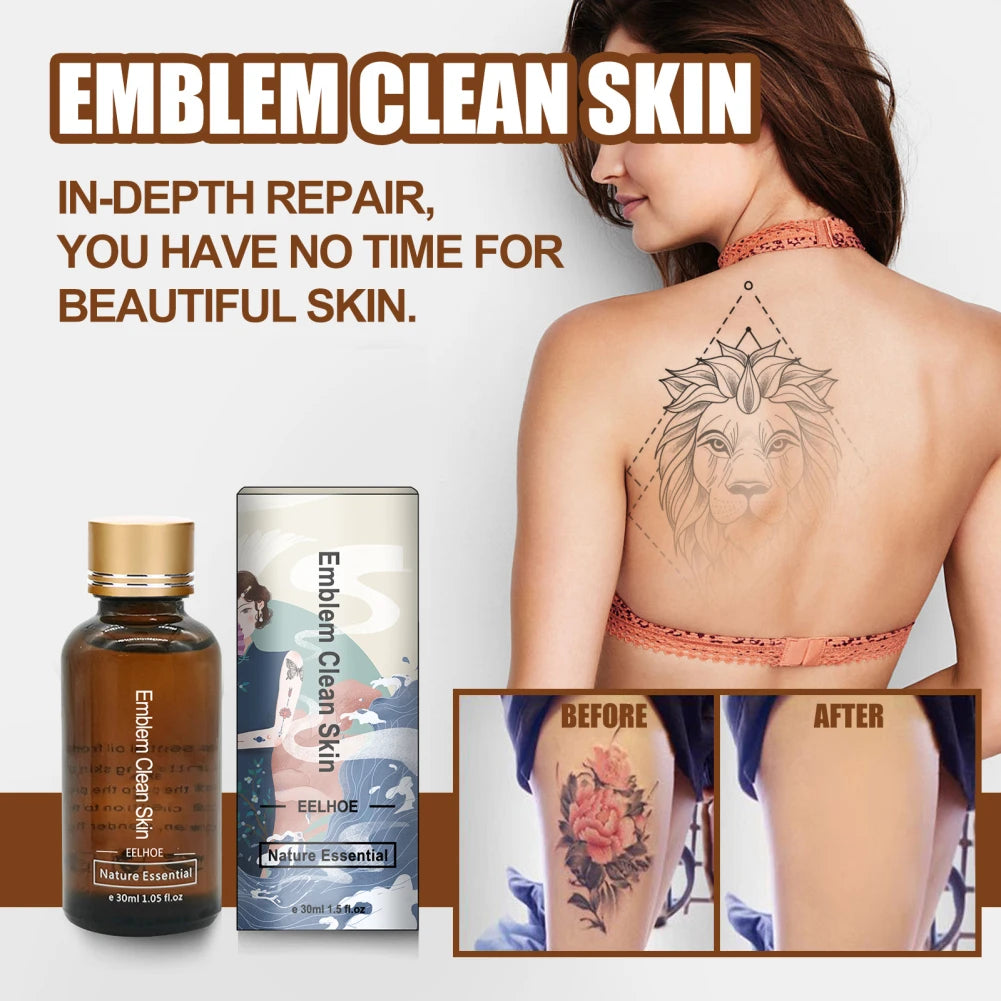 30Ml Safe Permanent Tattoo Removal Liquid