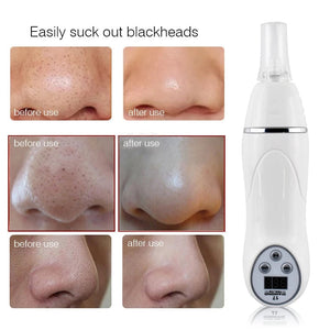 Electric Microdermabrasion Blackhead Remover Vacuum Pore Cleanser Tool