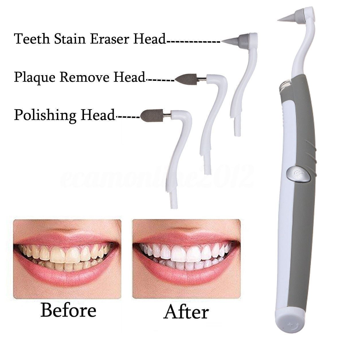Electric Sonic Dental Scaler Tooth Stain Remover with LED Light
