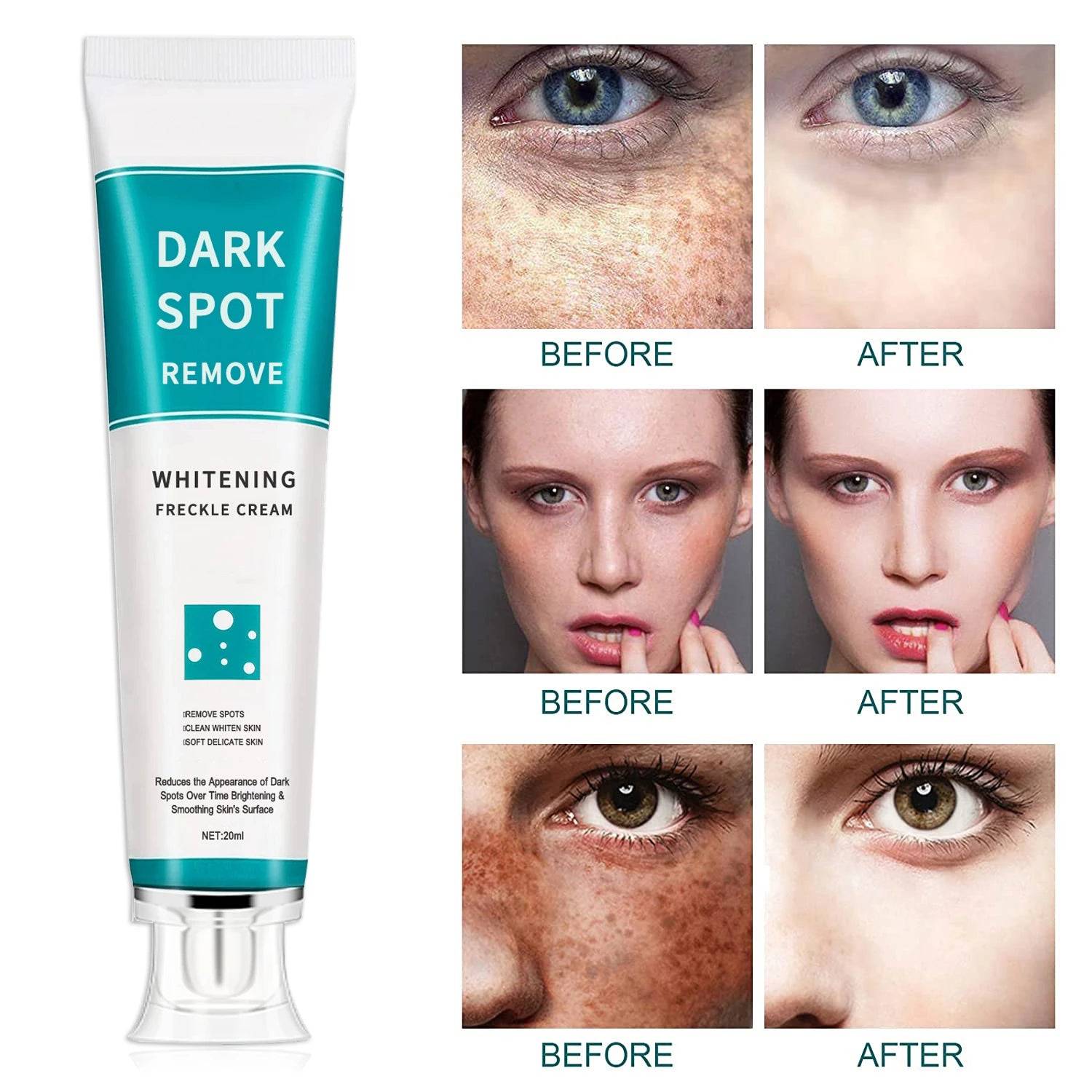 Freckle Cream Moisturizing Anti-Aging Remove Dark Spots