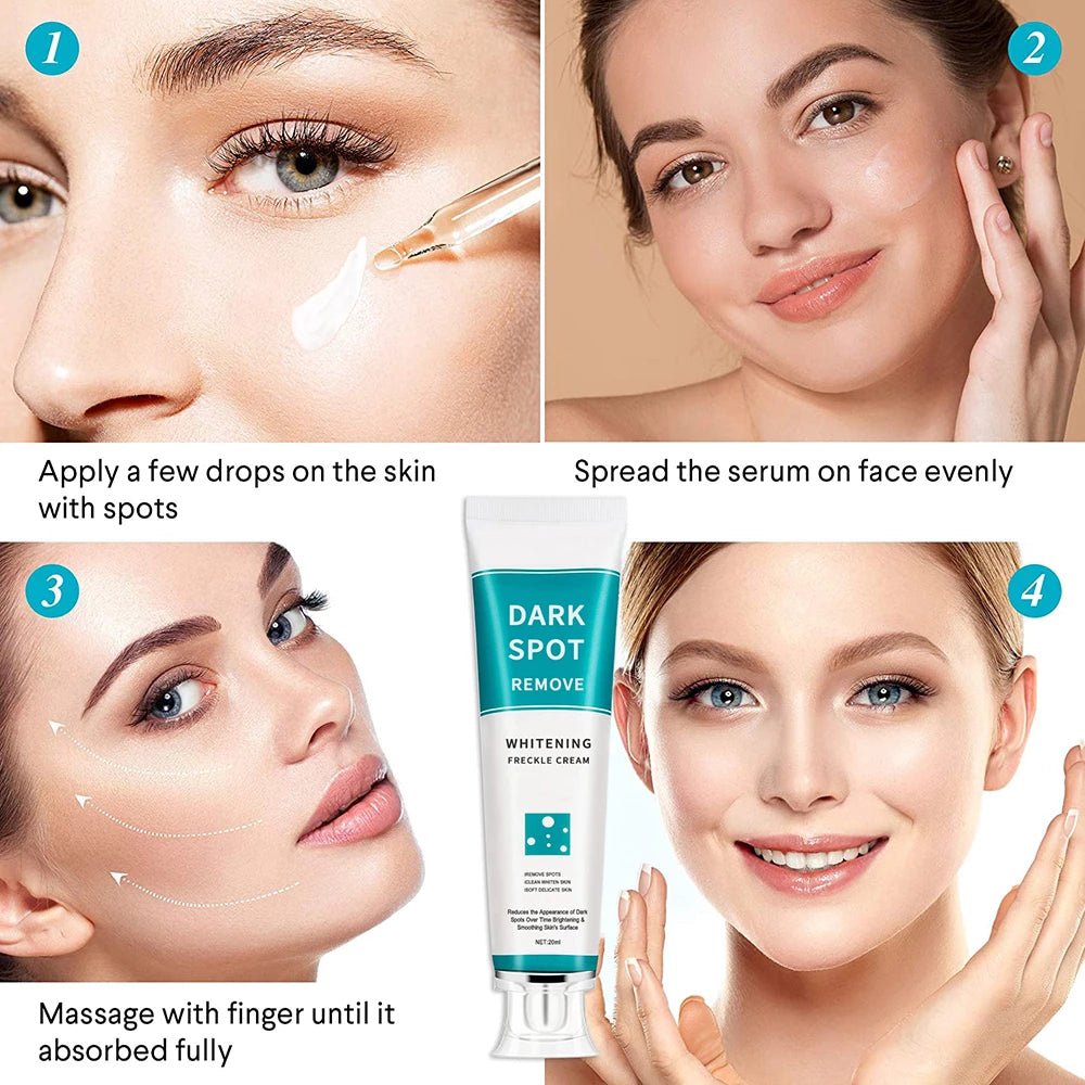 Freckle Cream Moisturizing Anti-Aging Remove Dark Spots