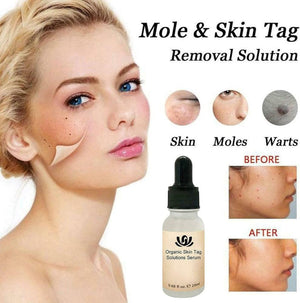 All-Natural Skin Tag and Mole Removal Serum, Herbal Formula
