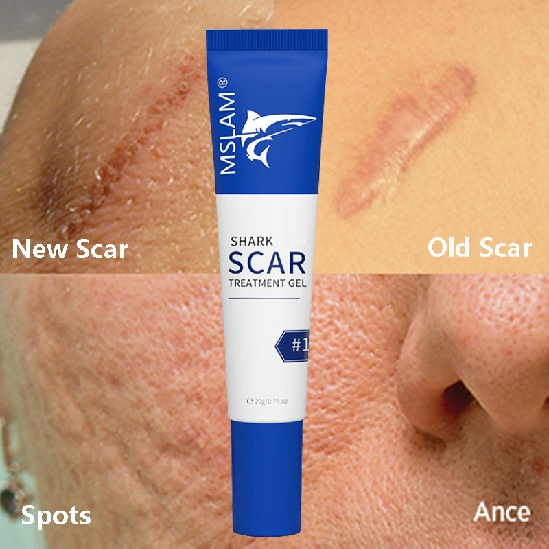 Scar Removal Cream Remove Acne Spots Treatment Stretch Marks Surgical Burns