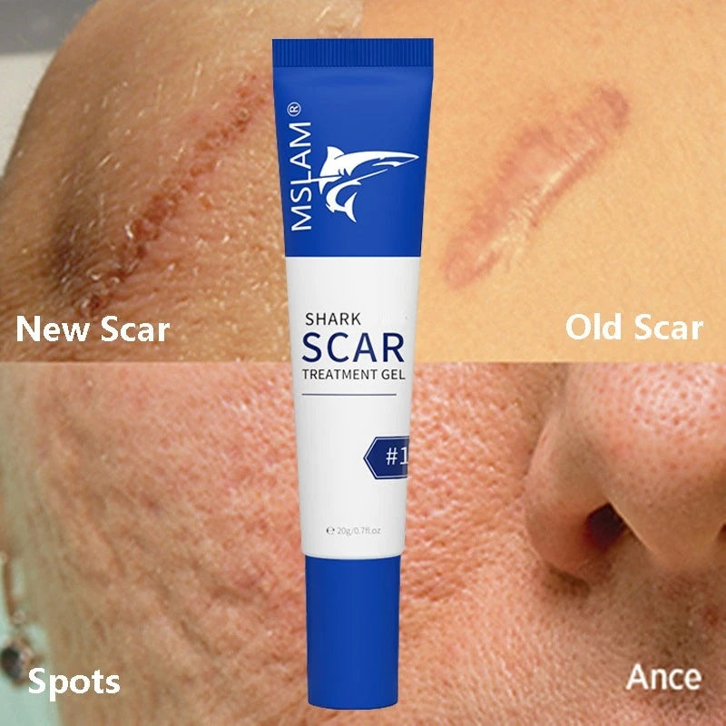 Scar Removal Cream Remove Acne Spots Treatment Stretch Marks Surgical Burns