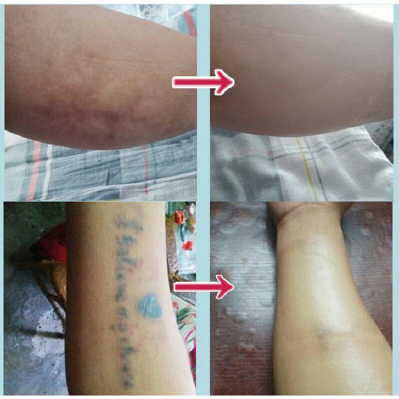 6PCS Tattoo And Scar Cover Up Super Invisible Tape